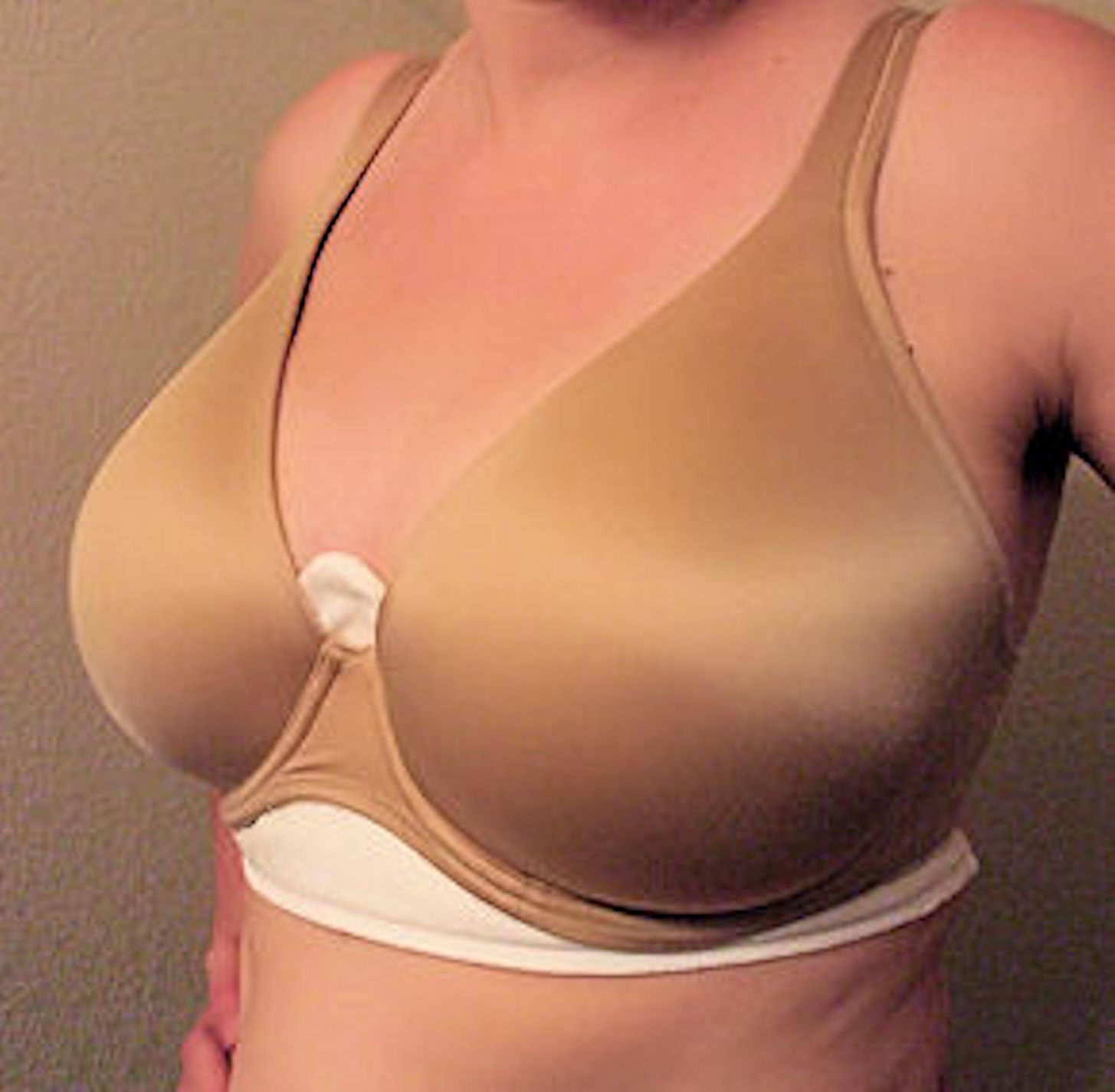 Pambra's The Original Unilateral Mastectomy Liner - XX-Large